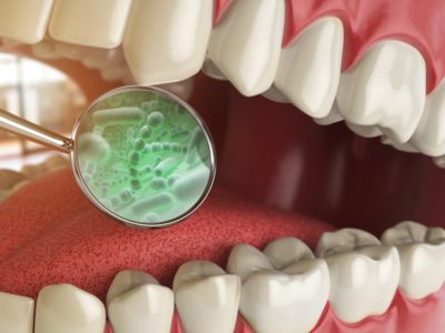 mirror inside a mouth showing germs indicating halitosis (bad breath) is present