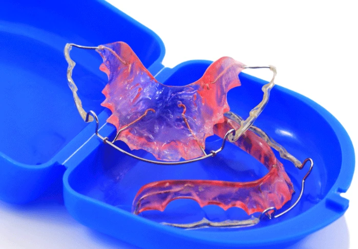 Wire retainers in Franklin, TN at East Franklin Dentistry.