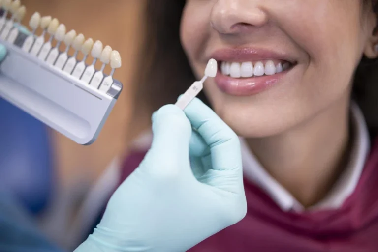 Porcelain Veneers: Who Is an Ideal Candidate?